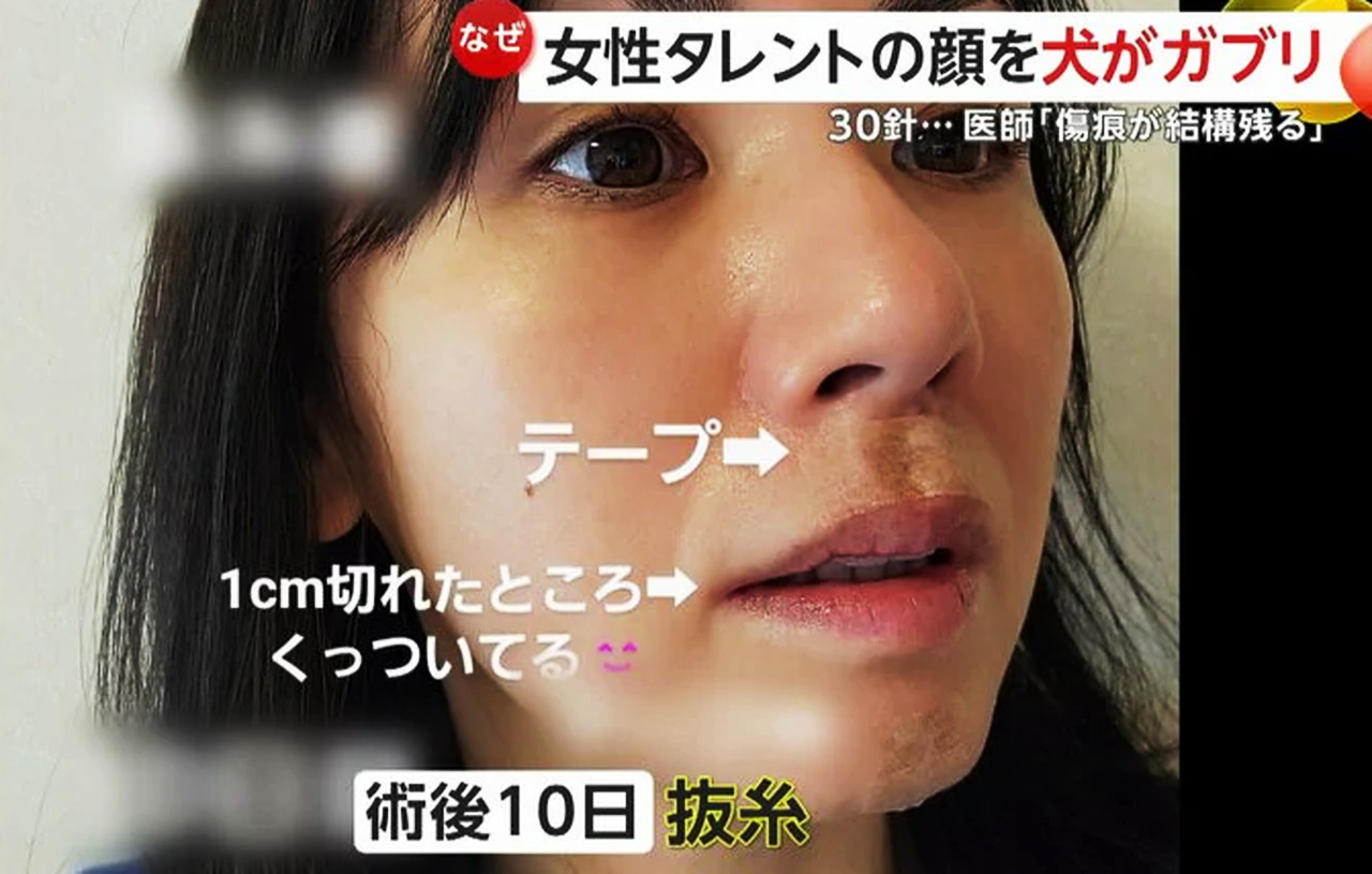 小島可奈子 犬 噛まれた FNN