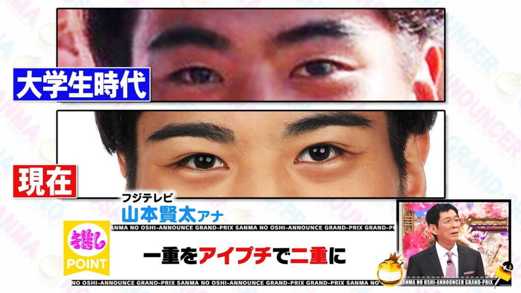 山本賢太アナ 整形 二重 FNS